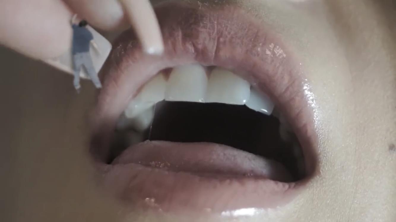 Roma hotel massacre 4