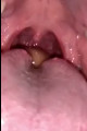 Chinese girl open mouth swallow grapes